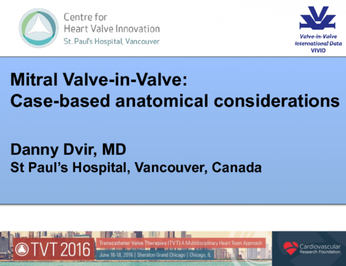 TAVR in Mitral Valve Bioprothesis (VIV): Anatomical Considerations