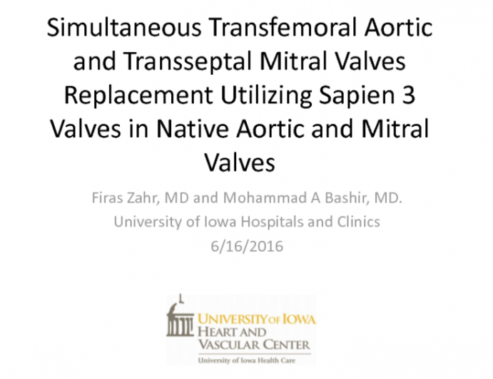 TVT 1139: Transfemoral Aortic and Transseptal Mitral Valve Replacements Utilizing Sapien 3 Valves in Native Aortic and Mitral Valves