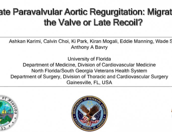 TVT 1075: Late Paravalvular Aortic Regurgitation: Migration of the Valve or Late Recoil?