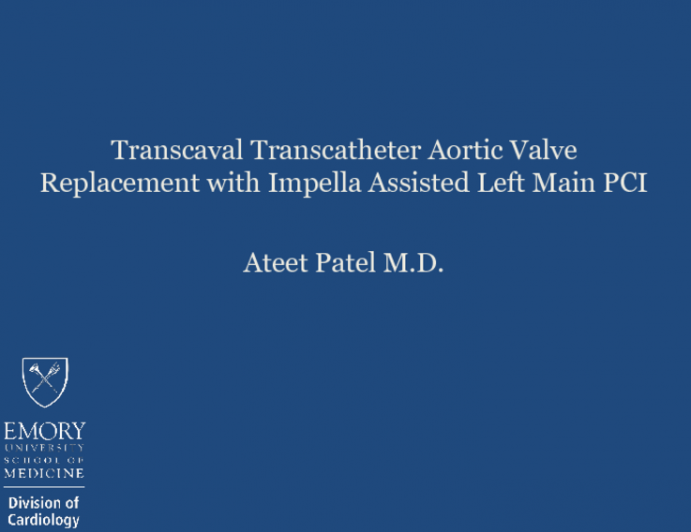 TVT 1060: Transcaval TAVR With Simultaneous Impella-Assisted Left-Main PCI