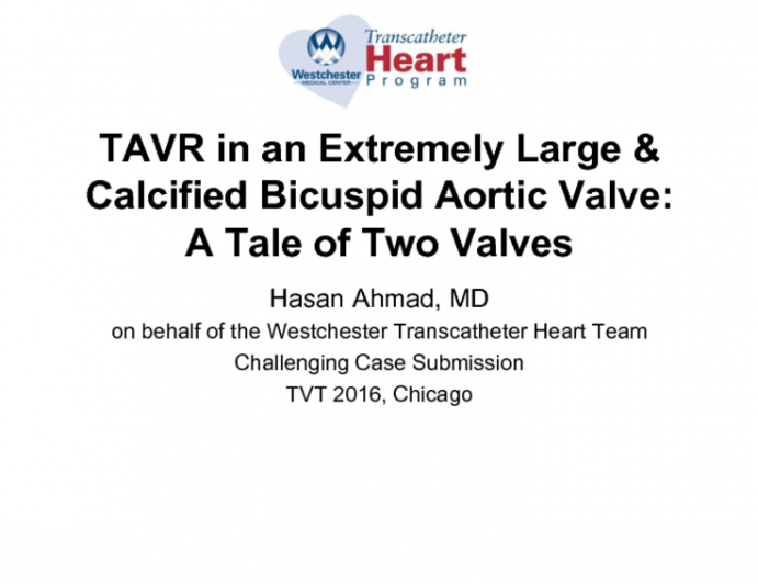 TVT 1080: TAVR in an Extremely Large and Calcified Bicuspid Aortic Valve  A Tale of Two Valves