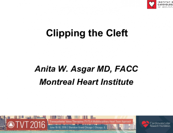 TVT 1171: Clipping the Cleft