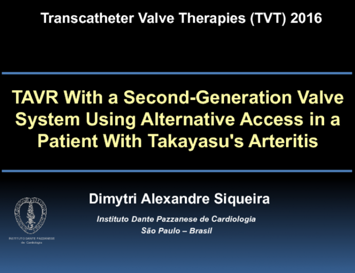 TVT 1115: TAVR With a Second-Generation Valve System Using Alternative Access in a Patient With Takayasu's Arteritis