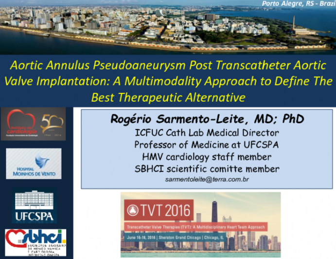 TVT 1125: Aortic Annulus Pseudoaneurysm Following Transcatheter Aortic Valve Implantation  A Multimodality Approach to Define the Best Therapeutic Alternative