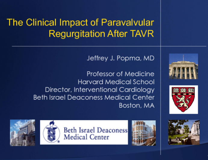 The Clinical Impact of Paravalvular Regurgitation After TAVR