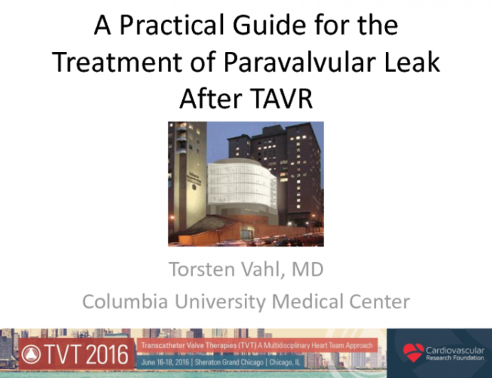 A Practical Guide for the Treatment of Paravavular Regurgitation After TAVR