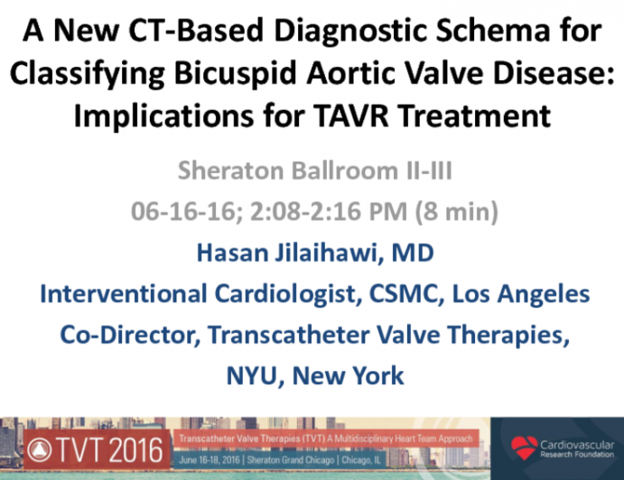 A New CT-Based Diagnostic Schema for Classifying Bicuspid Aortic Valve Disease: Implications for TAVR Treatment