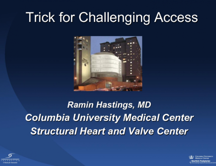 TVT 1169: Trick for Challenging Access