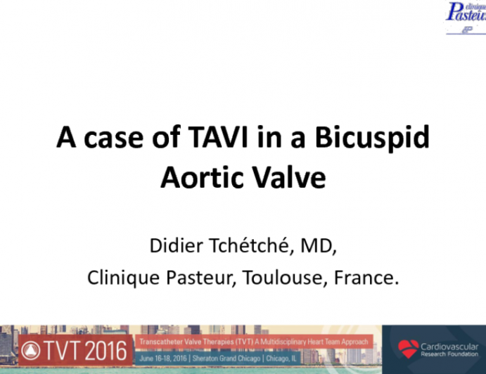 Anatomy of Bicuspid Aortic Valve