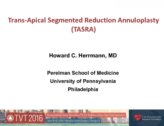 MitraSpan Suture-Based Annuloplasty