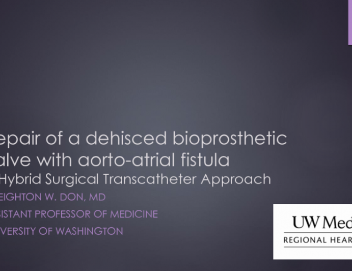 TVT 1180: Surgical Placement of a TAVR Valve to Treat an Aortoatrial Fistula, an Annular Abscess, and Severe Regurgitation in a Dehisced Bioprosthetic Valve