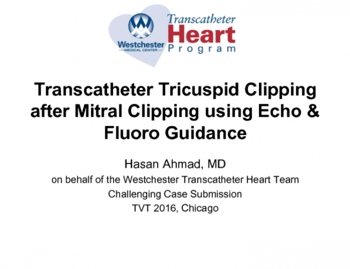 TVT 1076: Transcatheter Tricuspid Clipping After Mitral Clipping Using Echo and Fluoro Guidance