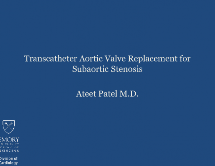 TVT 1059: Transcatheter Aortic Valve Replacement for the Treatment of Subaortic Stenosis