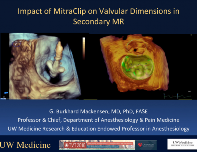 Impact of MitraClip on Vavlular Dimensions in Secondary MR