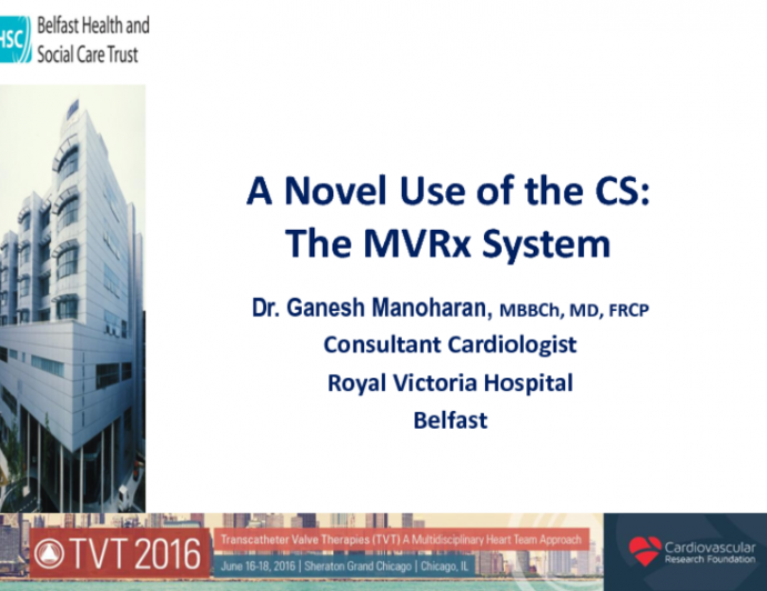 A Novel Use of the CS: The MVRx