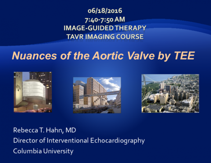 Nuances of the Aortic Valve by TEE