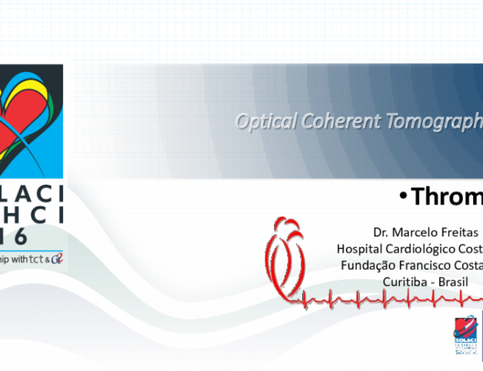 Optical Coherent Tomography: OCT