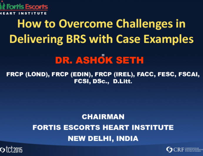 How to Overcome Challenges in Delivering BRS (With Case Examples)