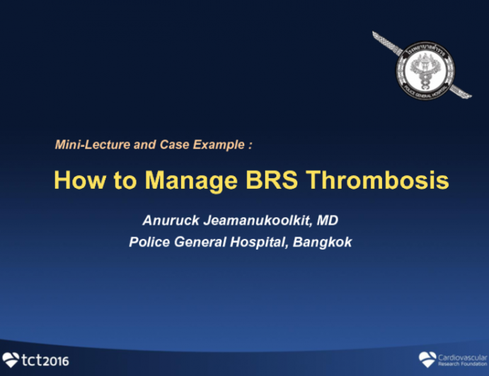How to Manage BRS Thrombosis (With Case Examples)