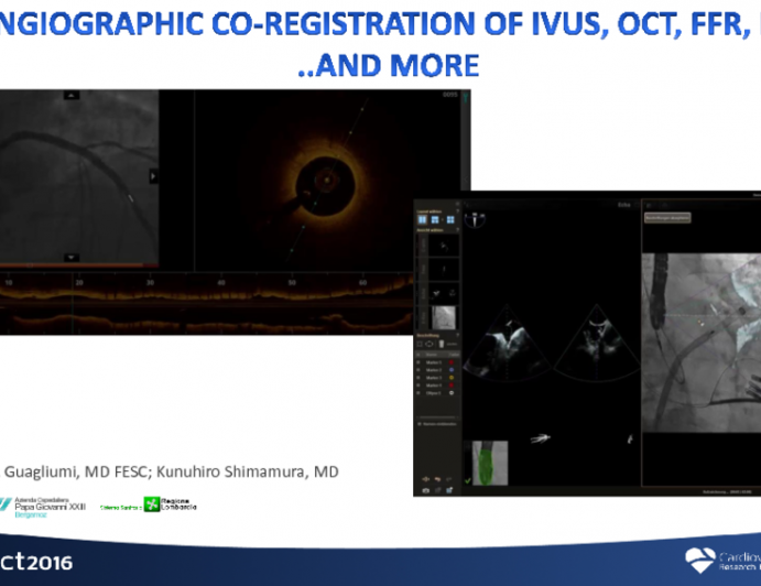 Angiographic Coregistration of IVUS, OCT, FFR, iFR, and More