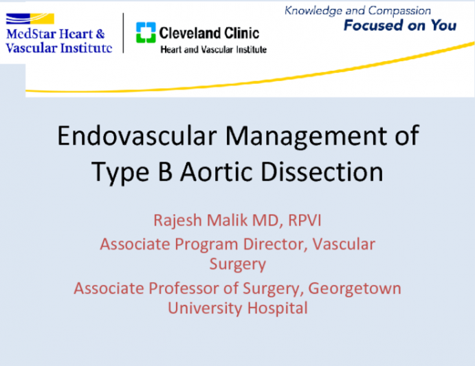 Endovascular Management of Type B Aortic Dissection
