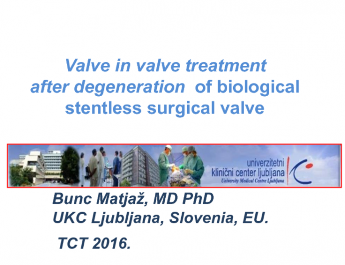 Case Reviews: TAVR Valve-in-Valve