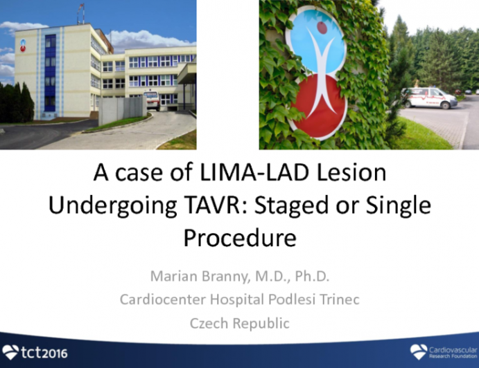 Czech Republic Presents: A Case of Ostial LAD Undergoing TAVR: Staged or Single Procedure?
