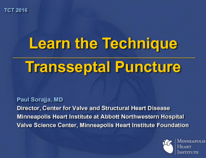 Step-by-step Basic Transseptal Puncture