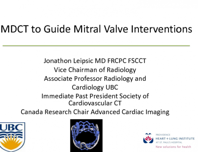 CT Imaging to Guide Selection and Treatment for Transcatheter MV Replacement: Lessons Learned From Early Feasibility Studies