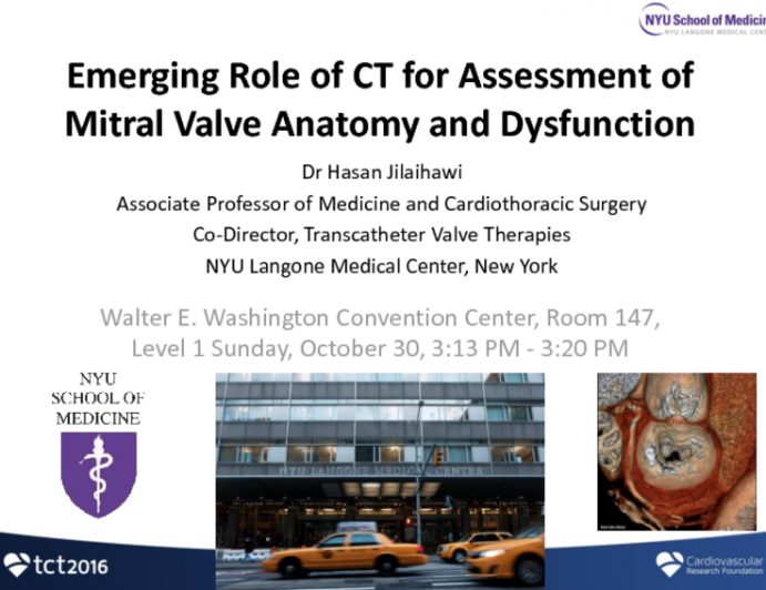 Emerging Role of CT for Assessment of Mitral Valve Anatomy and Dysfunction