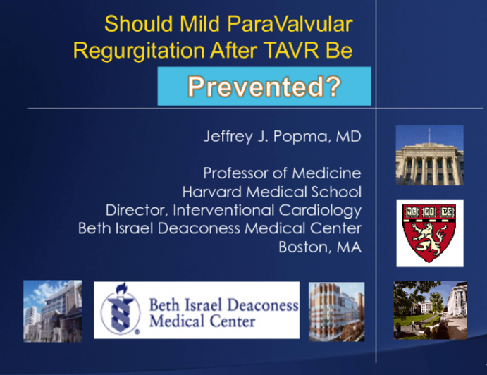 Complications 1. Para-Valvular Regurgitation: Should Mild Para-Valvular Regurgitation After TAVR Be Treated?