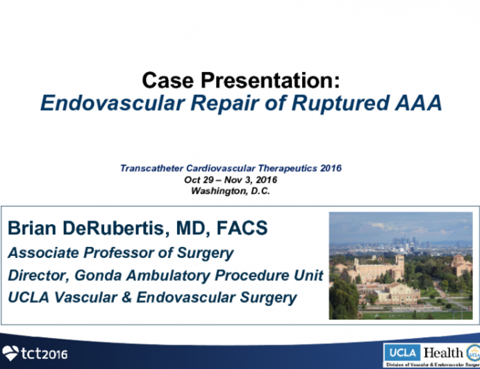 Case Presentation: Ruptured AAA