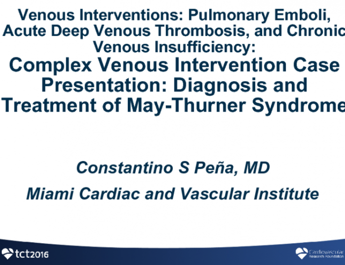 Complex Venous Intervention Case Presentation: Diagnosis and Treatment of May-Thurner Syndrome