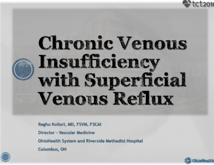 Case Presentation: Chronic Venous Insufficiency with Superficial Venous Reflux