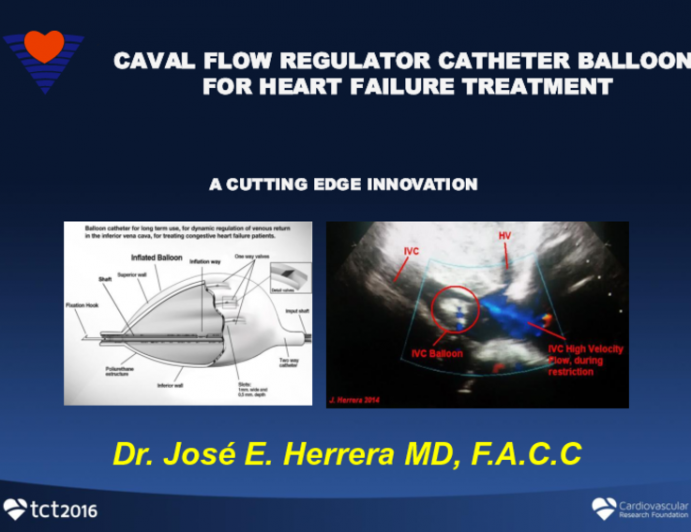 Caval Flow Regulator Catheter Balloon for Heart Failure Treatment