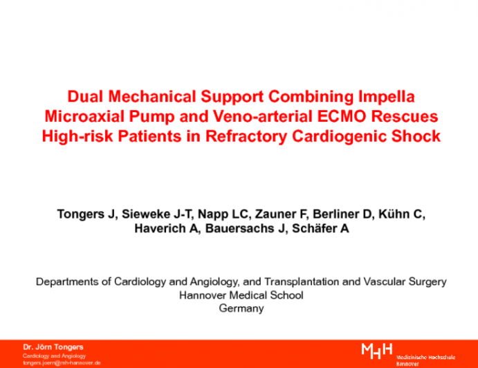 TCT 22: Dual Mechanical Support Combining Impella Microaxial Pump and Veno-Arterial ECMO Rescues High-risk Patients in Refractory Cardiogenic Shock