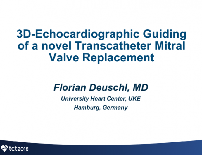 3D-Echocardiographic Guiding of a Novel Transcatheter Mitral Valve Replacement