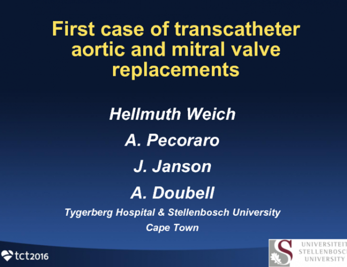 TCT 1497:First Case of Transcatheter Aortic and Mitral Valve Replacements