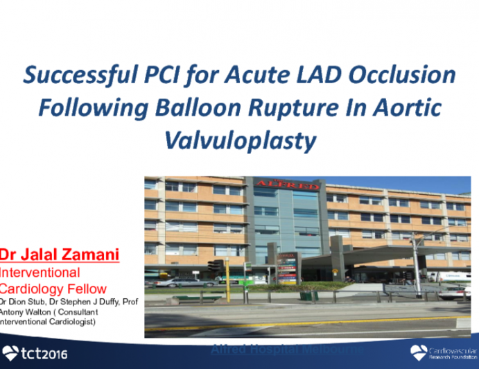 TCT 1540: Successful PCI for Acute LAD Occlusion Due to Balloon Rupture Following Aortic Valvuloplasty