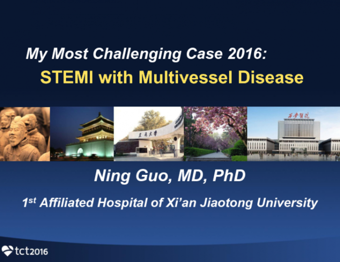 My Most Challenging Case 2016: STEMI with Multivessel Disease