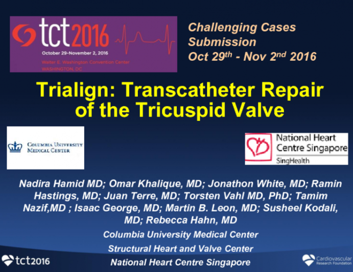 TCT 1611: Trialign: Transcatheter Repair of the Tricuspid Valve