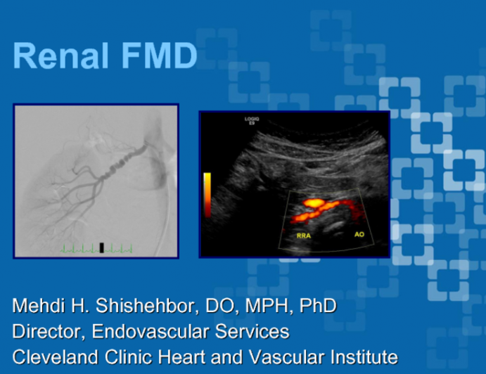 Treatment of Renal Artery Fibromuscalar Dysplasia: Indications, Techniques, and Outcomes