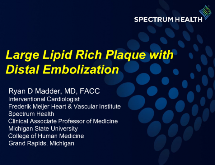 Case #5: Large Lipid Rich Plaque With Distal Embolization