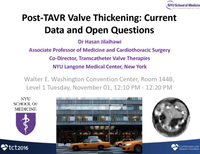 Post-TAVR Valve Thickening: Current Data and Open Questions