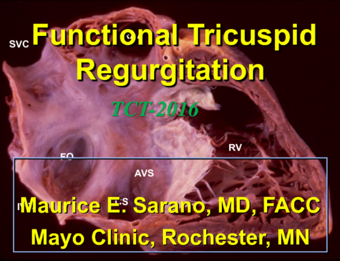 Impact and Natural History of Functional Tricuspid Regurgitation