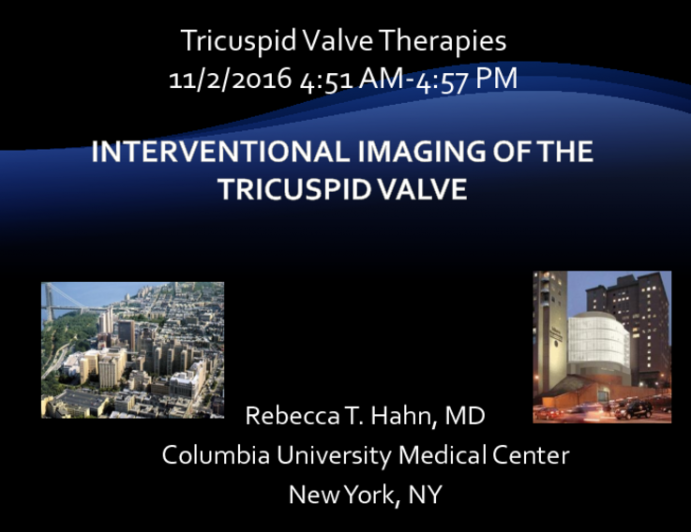 Interventional Imaging of the Tricuspid Valve