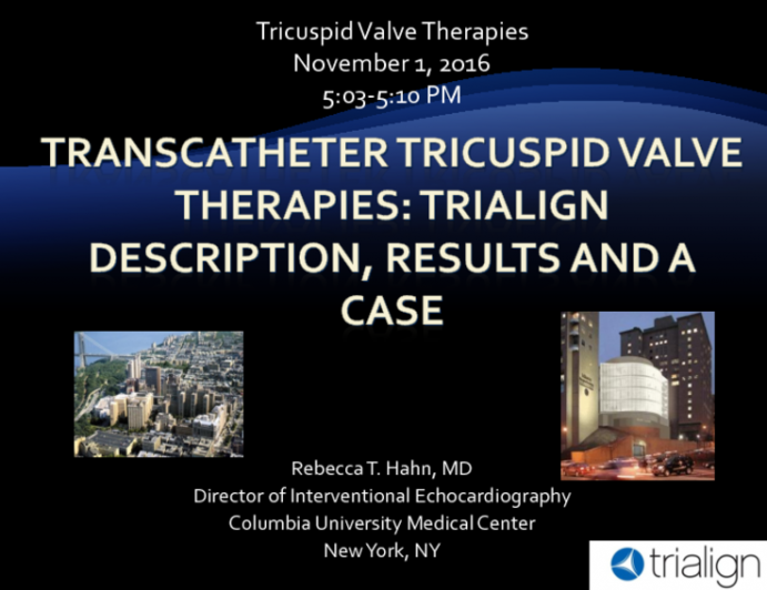 Transcatheter Tricuspid Valve Therapies 1: Trialign Description, Results and a Case