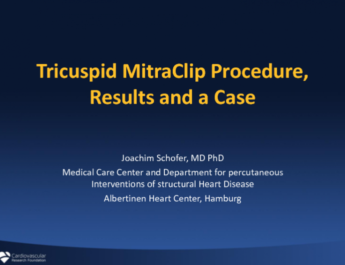 Transcatheter Tricuspid Valve Therapies 4: Tricuspid MitraClip Procedure, Results and a Case