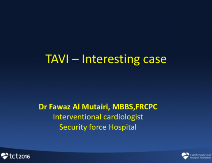 Saudi Arabia Presents: A Case of Coronary Compression After TAVR