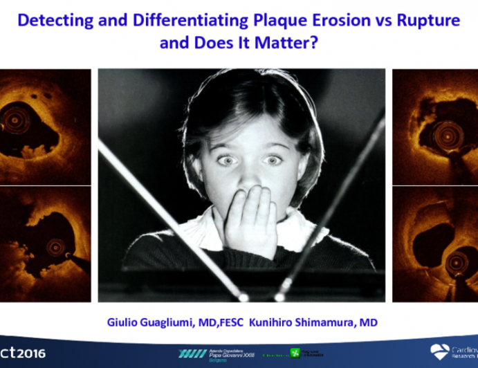 Detecting and Differentiating Plaque Erosion vs Rupture – and Does It Matter?